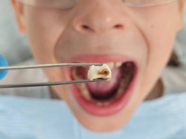 Best Weekend Emergency Dentist in Decordova, TX